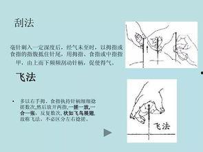 针灸怎么进针视频,视频教程详解